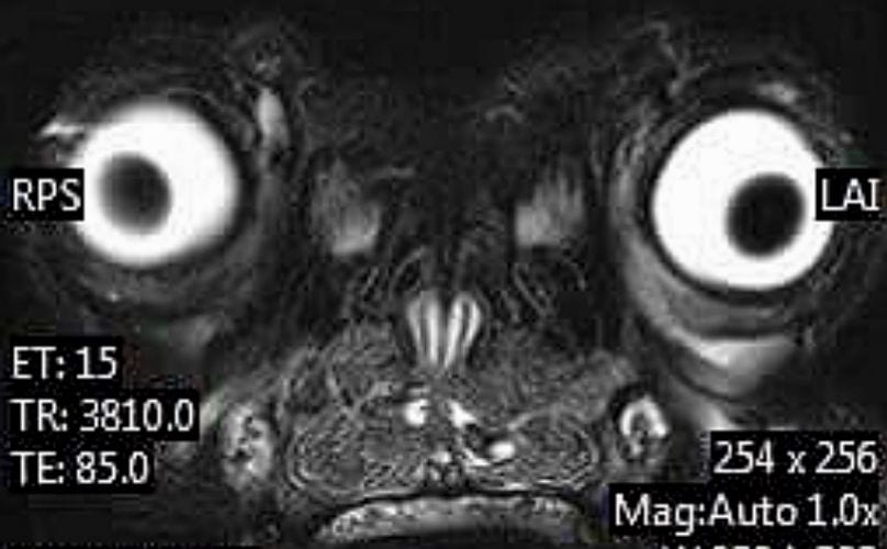 MRI Reveals That A Frenchie's Brain Is Almost As Cute And Awkward As They Are