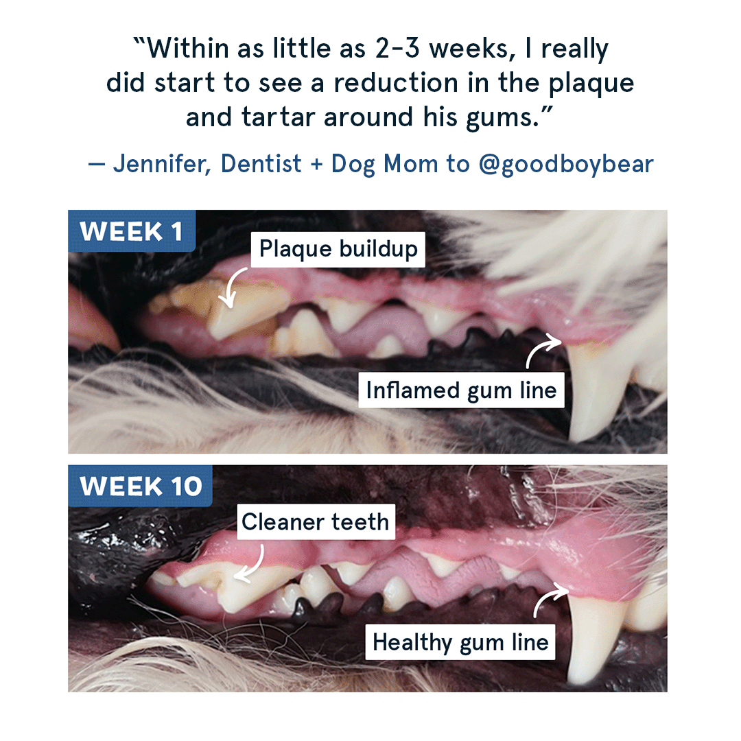 The Bright Dental Kit Subscription